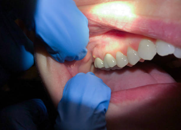 Best Pediatric Emergency Dentist in Egypt, AL